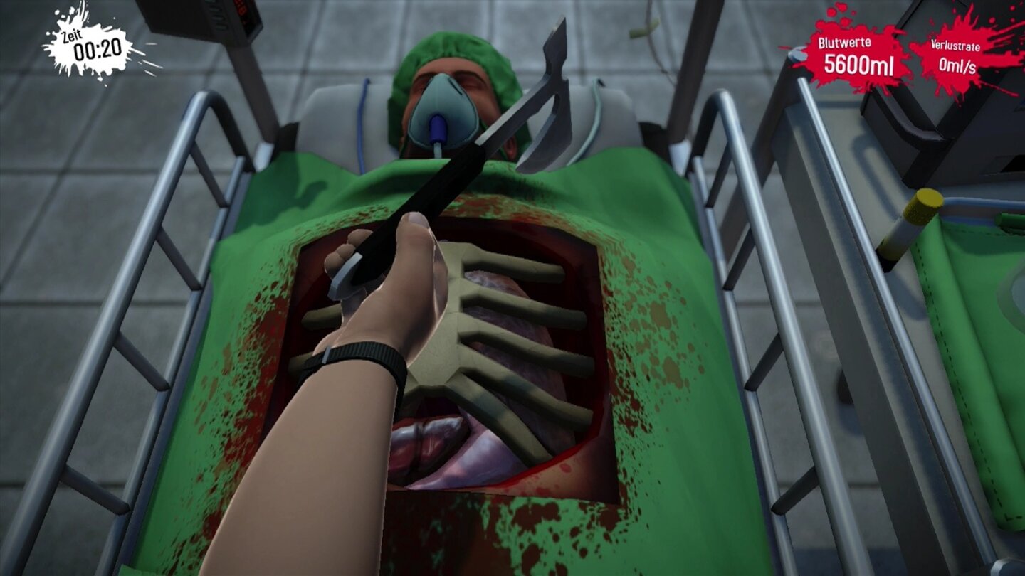 Surgeon Simulator - PS4-ScreenshotsHier müssen wir zuerst den Brustkorb zertrümmern, um an die darunter liegenden Organe zu kommen. Dieses Puzzleprinzip reizt anfangs noch ein wenig, mutiert aber schnell in frustiges Trial & Error.