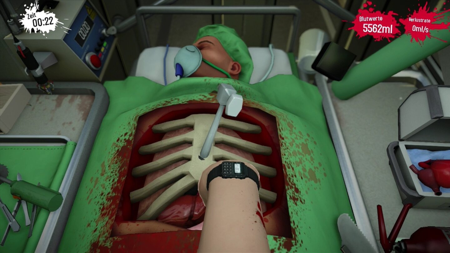 Surgeon Simulator - PS4-ScreenshotsDie Glitches sind eigentlich eher harmlos und unfreiwillig komisch. Hier verhindert ein fetgeglitchter Hammer aber, dass wir die Mission beenden können. Ärgerlich!