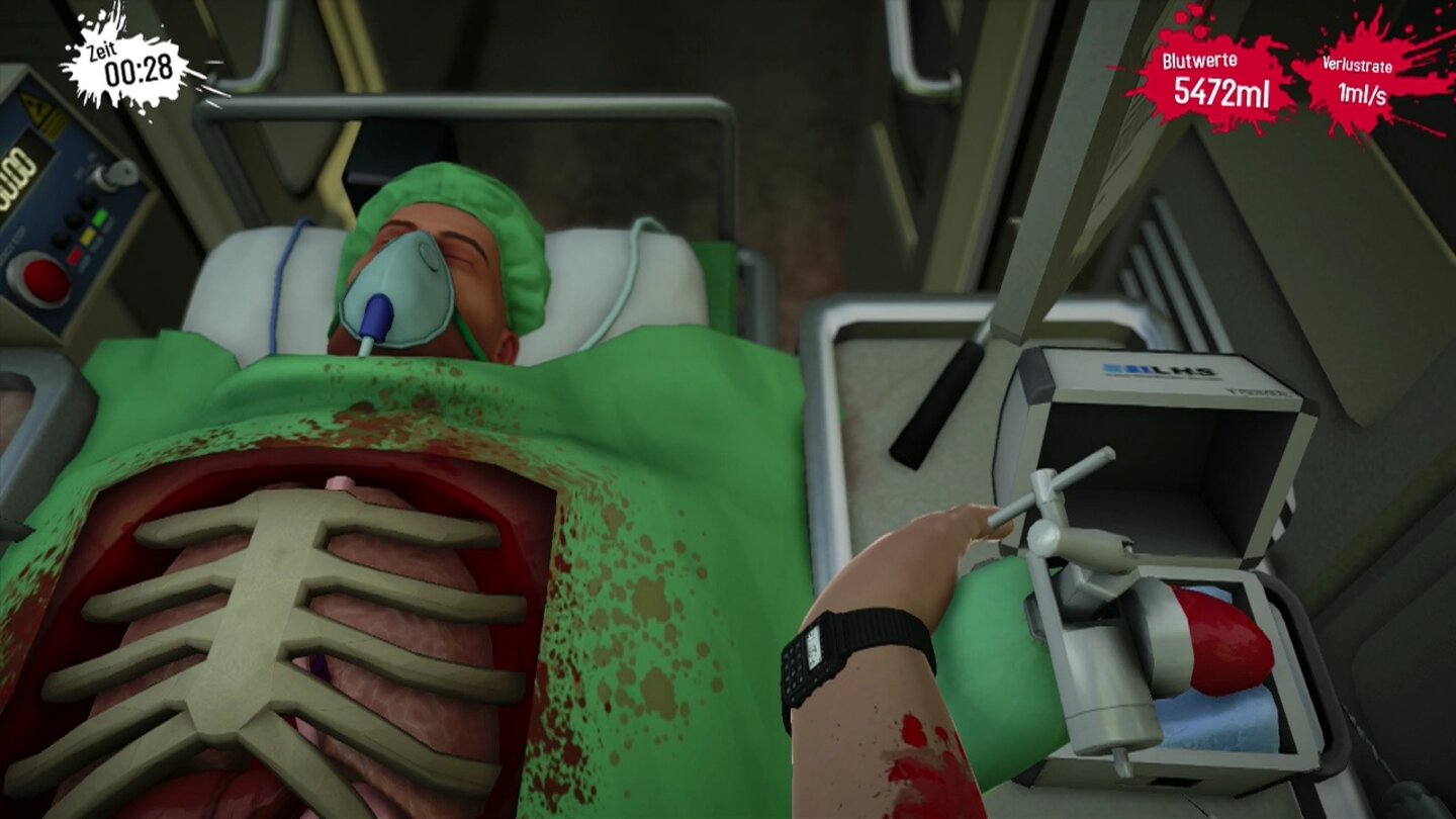 Surgeon Simulator - PS4-ScreenshotsIm Krankenwagen fliegt uns dauernd Operationsbesteck in den Patienten. Das soll Abwechslung bringen, frustriert uns aber nur zusätzlich.