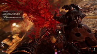 Necromunda: Hired GunMit dem verdienten Geld aus den Missionen lassen wir uns beim Doktor neue Bionics einbauen. Diese kybernetischen Verbesserungen geben uns bessere Werte und schalten Spezialattacken frei.