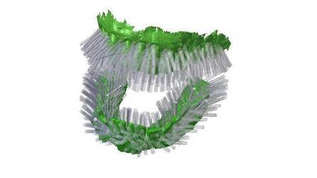 3D-Drucker - Personalisierte, 3D-gedruckte Zahnbürsten