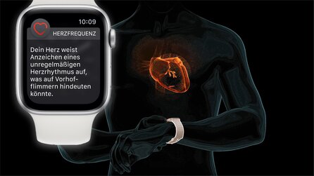 Apple Watch hilft bei Diagnose - »Es hat mir wirklich das Leben gerettet«