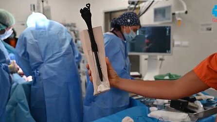 Ein Krankenhaus in Madrid hat eine Technologie aus der Luft- und Raumfahrt genutzt, um eine Amputation zu verhindern – jetzt kann der Patient wieder laufen