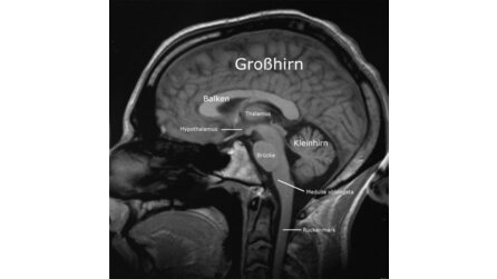 Computerspiele - Männer neigen eher zur Sucht als Frauen