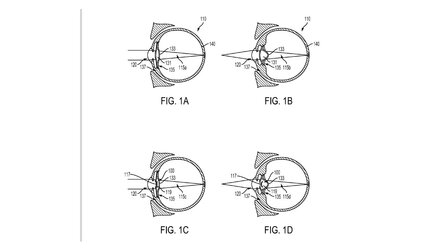 Google-Computer im Auge - Sony und Samsung mit smarten Kontaktlinsen