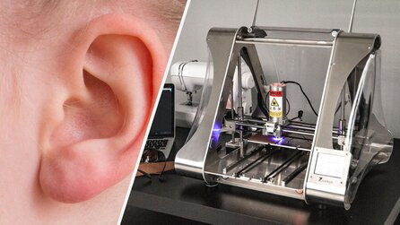 Echtes Ohr aus dem 3D-Drucker: Neue Technologie könnte Tausenden Menschen helfen