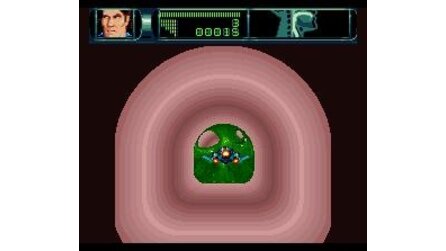 Rex Ronan: Experimental Surgeon SNES
