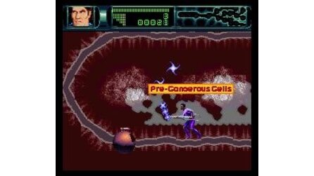 Rex Ronan: Experimental Surgeon SNES