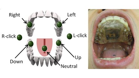 Tongue Drive System - Zungen-gesteuerte Maus im Mund