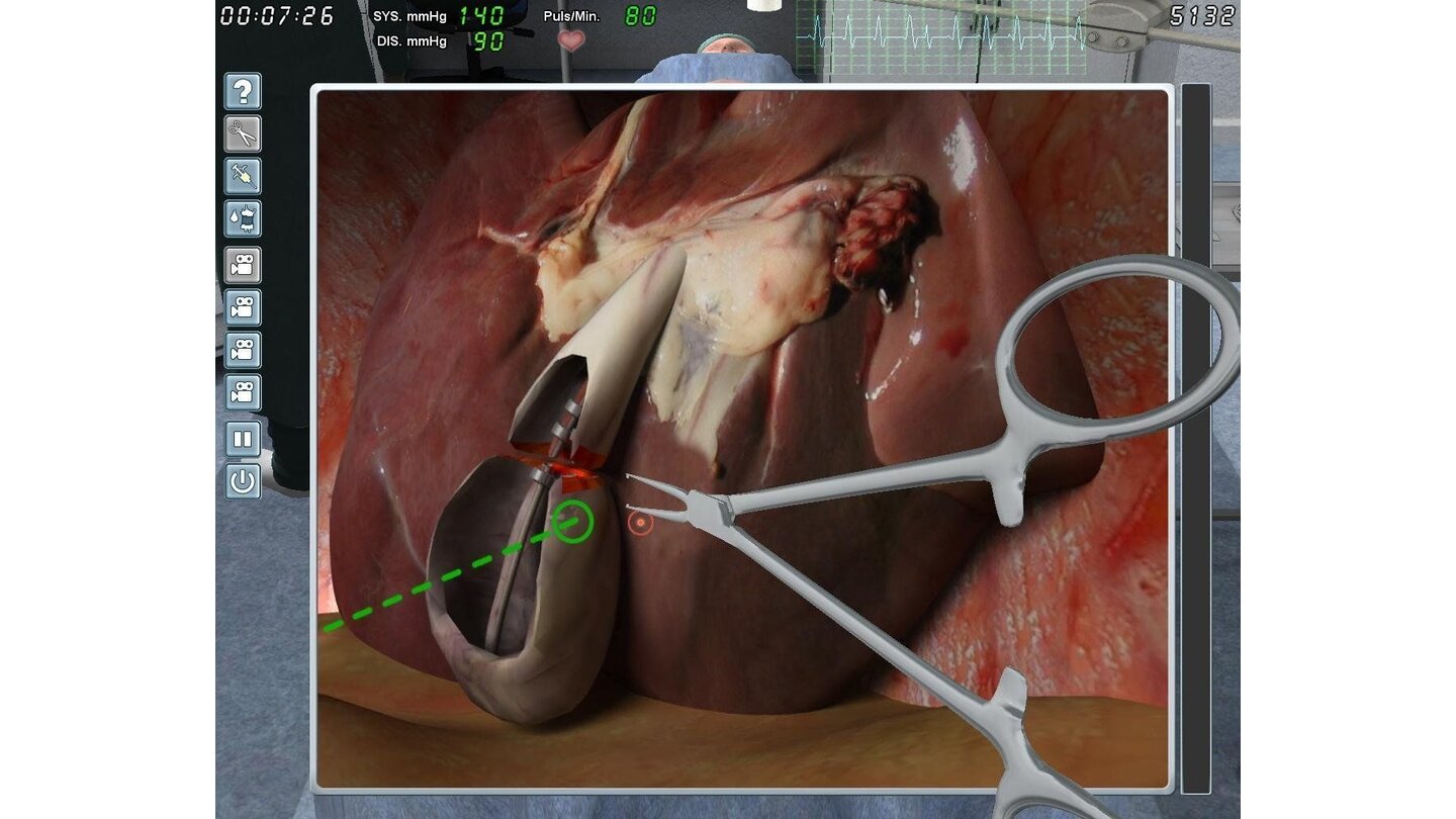 Chirurgie Simulator