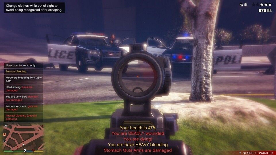 Die GTA 5 Schusswaffen-Mod »GunShot Wound« erweitert das Spiel um ein realistisches Verletzungsssystem.