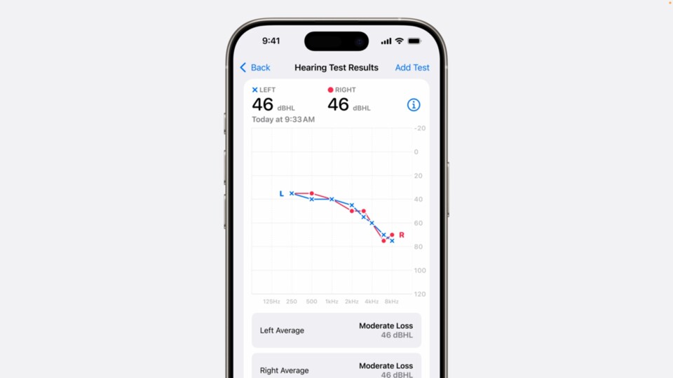 Mit den neuen AirPods soll ein waschechter Hörtest ermöglicht werden.