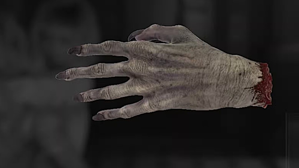 Abgetrennte Gliedmaßen kennen Fans von Resident Evil 7 und Resident Evil 2 Remake zur Genüge.