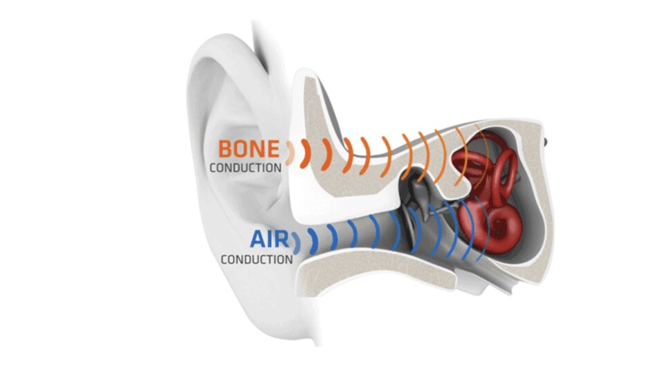 Der Schall wird über den Knochen und nicht über die Luft übertragen. (Quelle: Shokz)