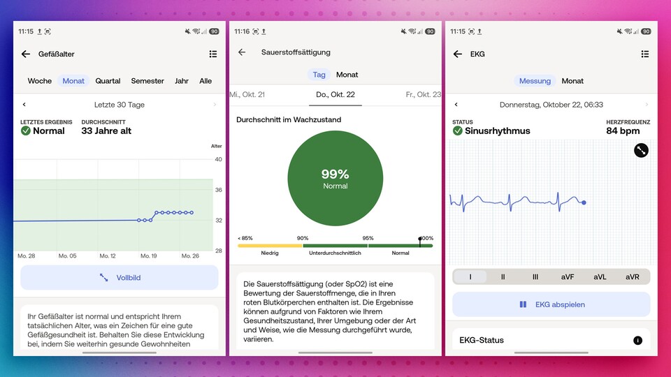 Die Withings Scan 2 bietet noch mehr Gesundheitsfunktionen, wie ein EKG. Das könnt ihr in der App auch nochmal abspielen lassen.