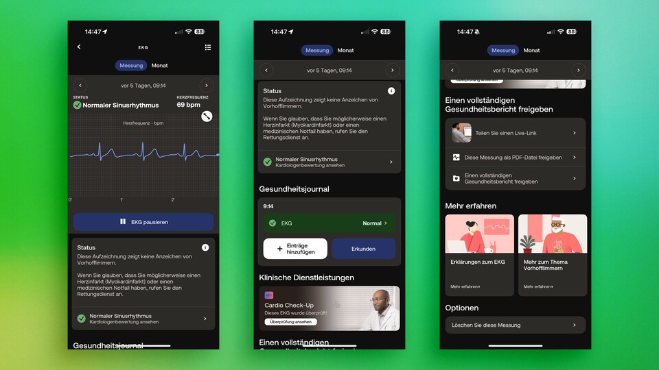Withings bietet in seinen Premium-Plan vielversprechende Funktionen, die nicht essenziell sind – wie Cardio Check-up.