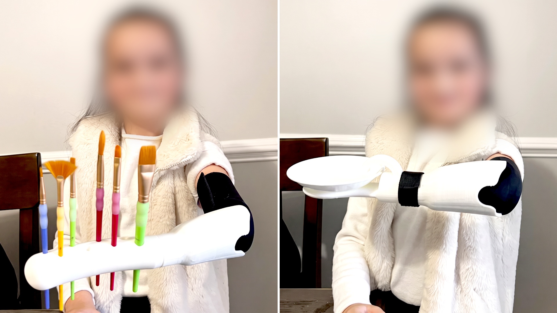 3D-Druck - Ein Student verbrachte über 100 Stunden vor einem 3D-Drucker, um für seine 7-jährige Schwester eine Multifunktionsprothese zu entwickeln