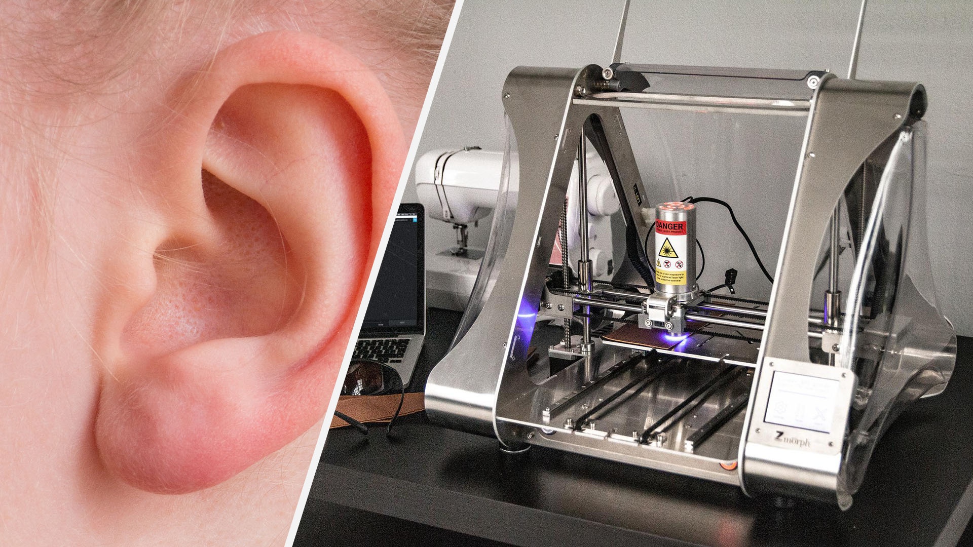 #Ohr aus dem 3D-Drucker – Neue Technologie könnte Tausenden Menschen helfen