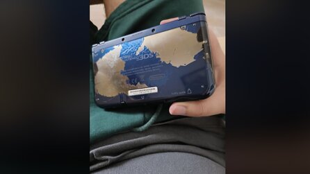 Nintendo-Fan erfährt auf schmerzhafte Art und Weise, dass man seinen 3DS nicht bei heißem Wetter in der Hosentasche haben sollte