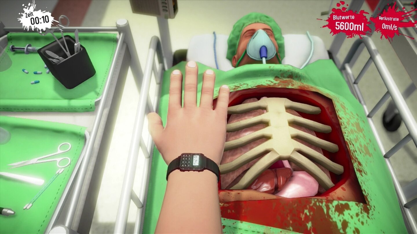 Surgeon Simulator - PS4-ScreenshotsWas nun? Das puzzleartige Herausfinden der richtigen Vorgehensweise ist eine große Stärke des Spiels, artet aber zu schnell in frustrierendes Trial & Error aus.