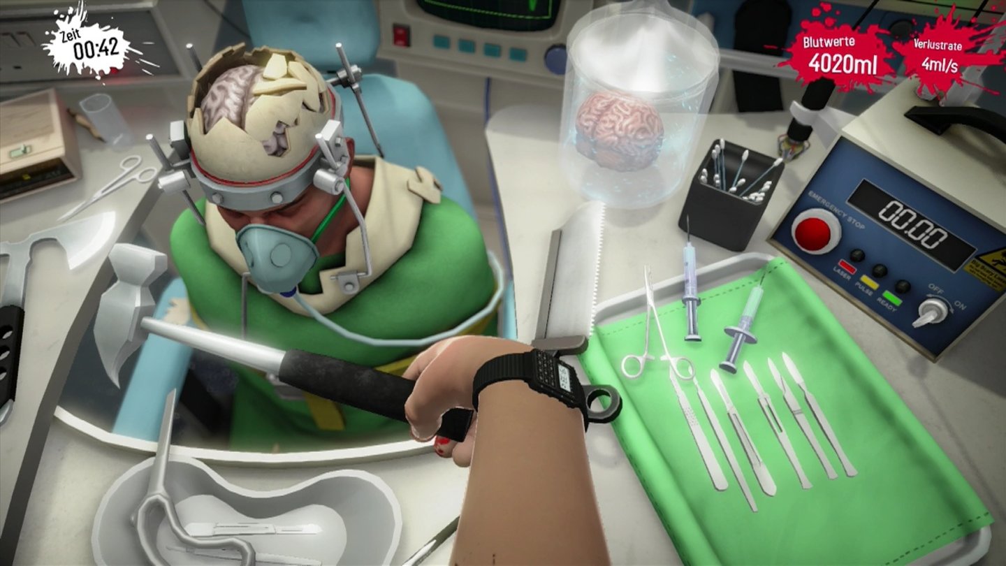 Surgeon Simulator - PS4-ScreenshotsBei der Gehirntransplantation können wir den Arm auch per Bewegungssteuerung drehen und neigen. Wir raten dringend davon ab.