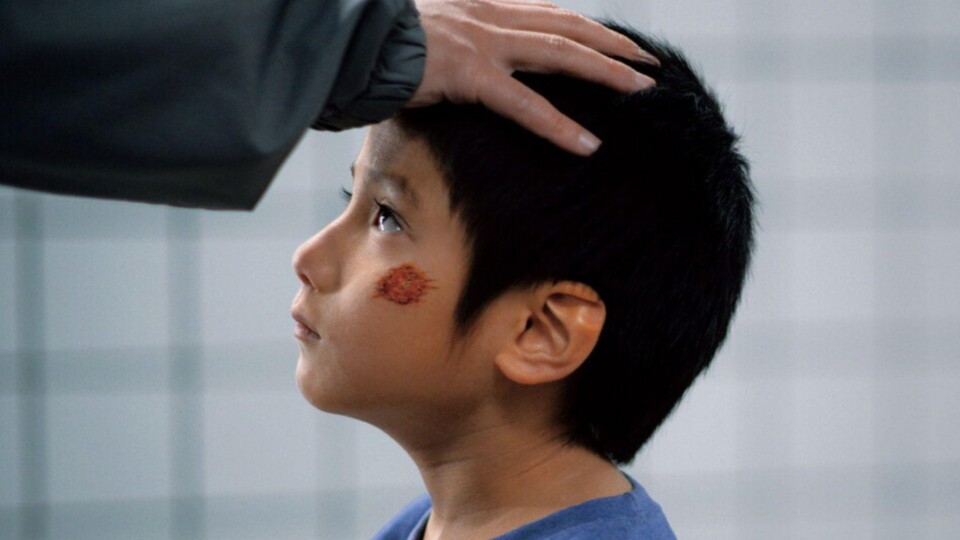 Hinter der Narbe im Gesicht des Jungen verbirgt sich eine traurige Geschichte. (© Kotake Create Toho)