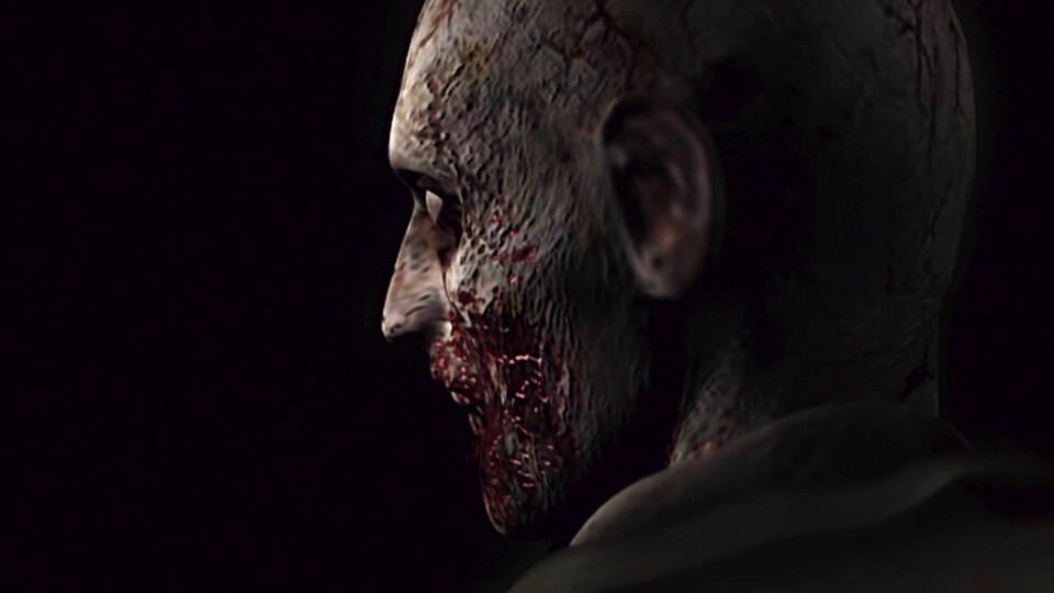 Wenn Spieler:innen an Resident Evil denken, haben viele noch immer die klassische Zombie-Action vor Augen.