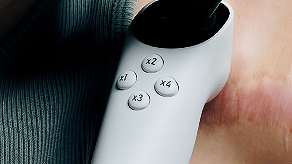 Neben den vier X-Tasten auf der Vorderseite gibt es auch noch zwei weitere auf dem Adaptive Joystick.
