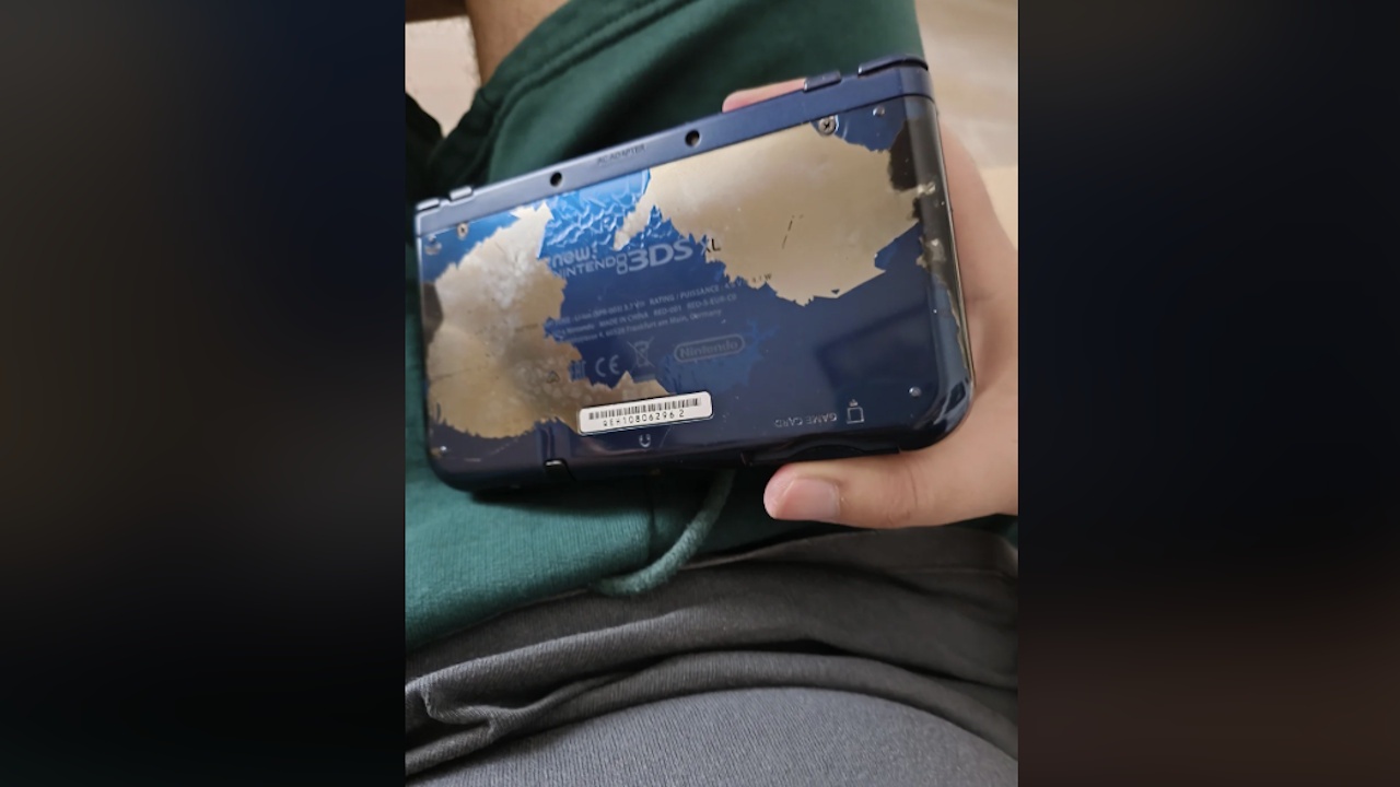 Nintendo-Fan erfährt auf schmerzhafte Art und Weise, dass man seinen 3DS nicht bei heißem Wetter in der Hosentasche haben sollte